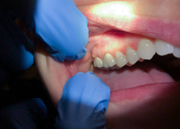 Best Emergency Orthodontic Repairs in Ironwood, MI